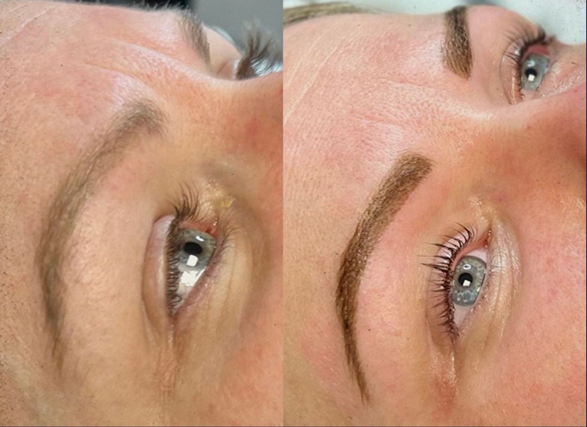 Lash Lift