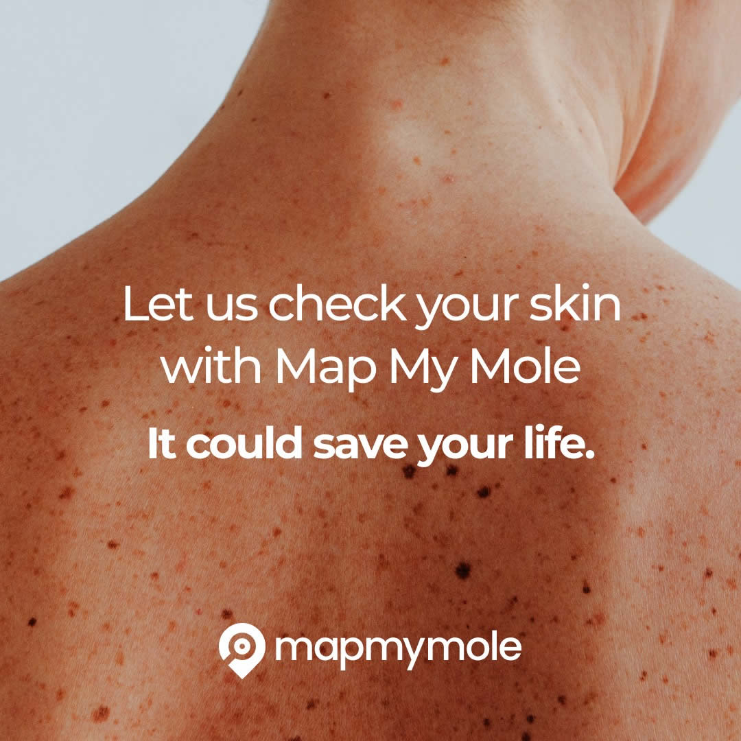 Map My Mole